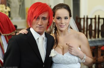 Wydała 50 tys. zł na poprawę urody. Dziś trudno ją rozpoznać