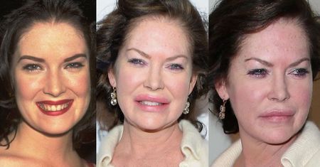 KU PRZESTRODZE: Oszpecona operacjami Lara Flynn Boyle walczy na ściance o uśmiech (ZDJĘCIA)