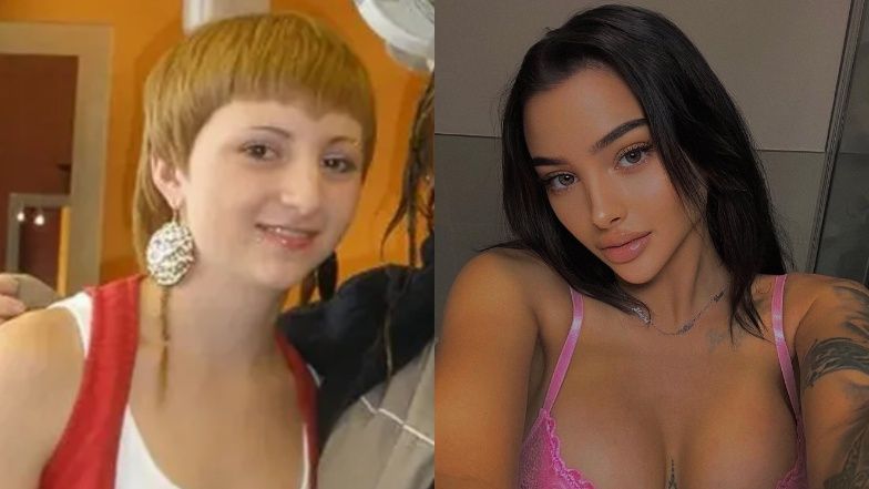 Céline Centino wydała majątek na operacje plastyczne 