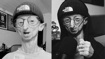 Nie żyje 28-letni influencer. Michiel Vandeweert zmagał się z rzadką chorobą genetyczną