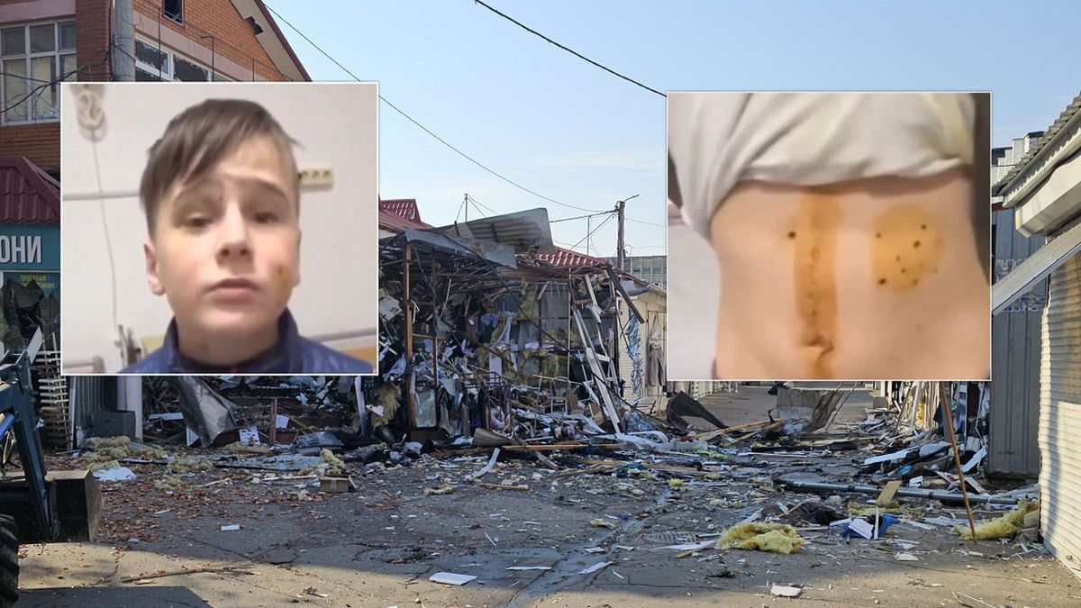 Chłopiec mówił o ataku drona.