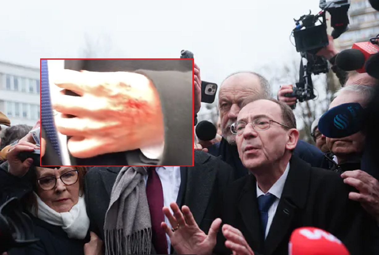 Mariusz Kamiński poszkodowany w trakcie awantury pod Sejmem? Jest nagranie
