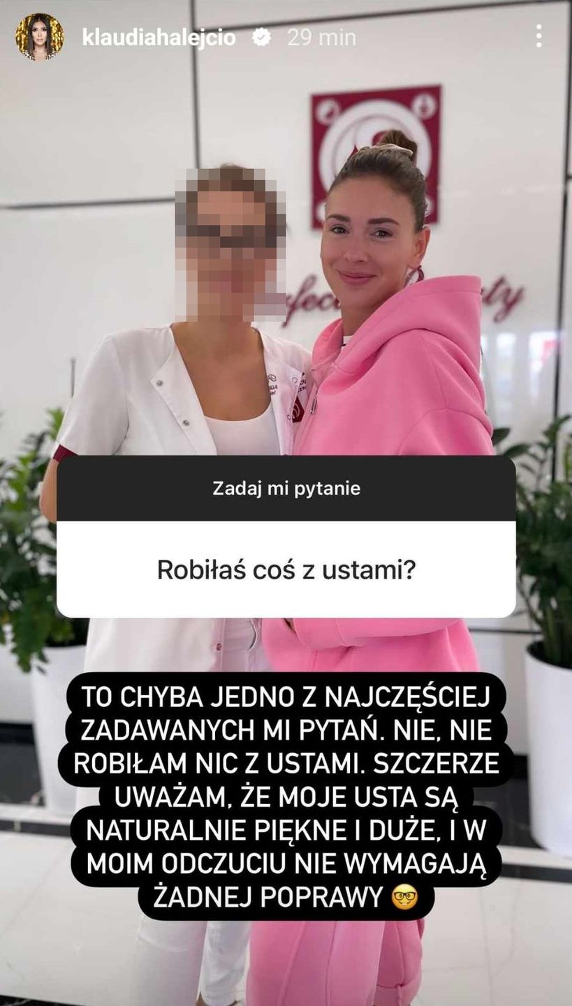 Klaudia Halejcio wymienia zabiegi medycyny estetycznej, jakim się poddała