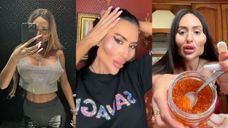 Mówi, że ma NAJWIĘKSZE POLICZKI NA ŚWIECIE. 37-latka wydała na to fortunę. Nie uwierzycie, jak wyglądała "PRZED"