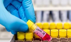 Lek na COVID-19. UE podpisała umowę na dostawy