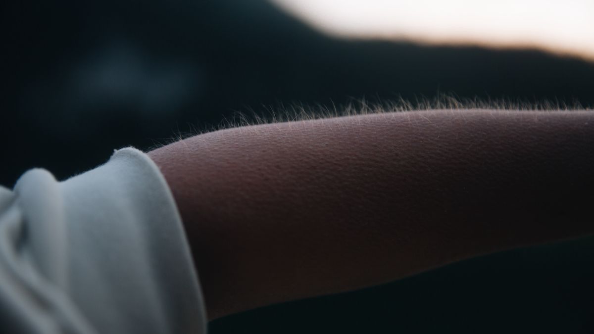 Rak często daje objaw na skórze. Nagłe pojawienie się jasnych włosów to sygnał alarmowy