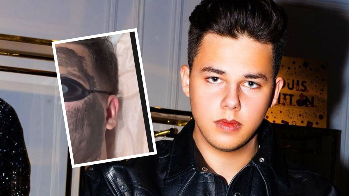 Allan Enso cierpi dla urody?