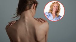 Bycie zbyt szczupłym groźniejsze niż nadwaga? Zaskakujące wyniki badań