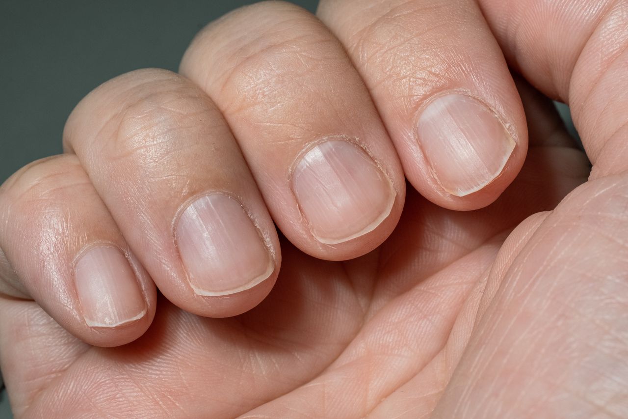 What your nails say: Seven alarming signs you shouldn't ignore