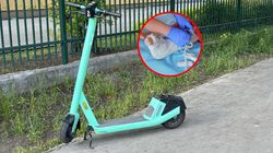 Plaga urazów przez hulajnogi. "Nie ma tygodnia bez hospitalizacji"