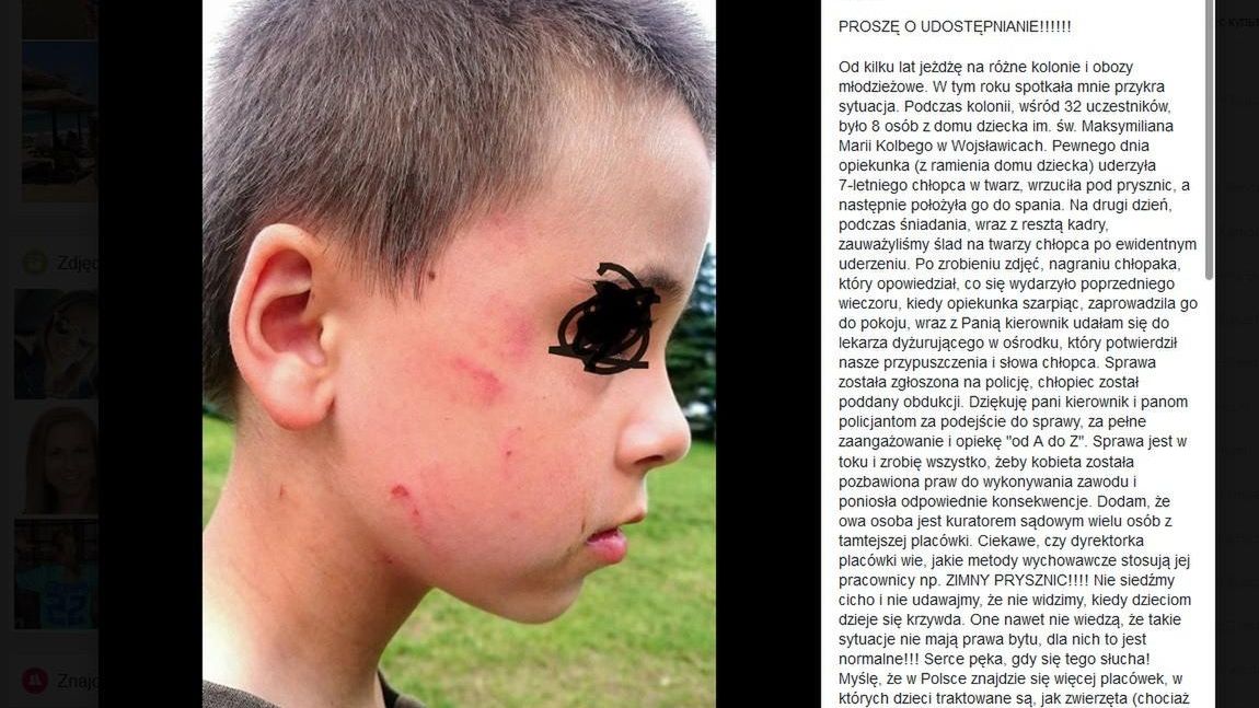 Chłopiec z domu dziecka uderzony przez opiekunkę. To nie był pierwszy raz?