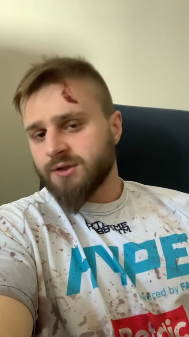 Gwiazdor Fame MMA został napadnięty we własnym domu?!