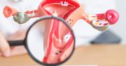 Zmiany keratotyczne w cytologii – co oznaczają i czy są groźne?
