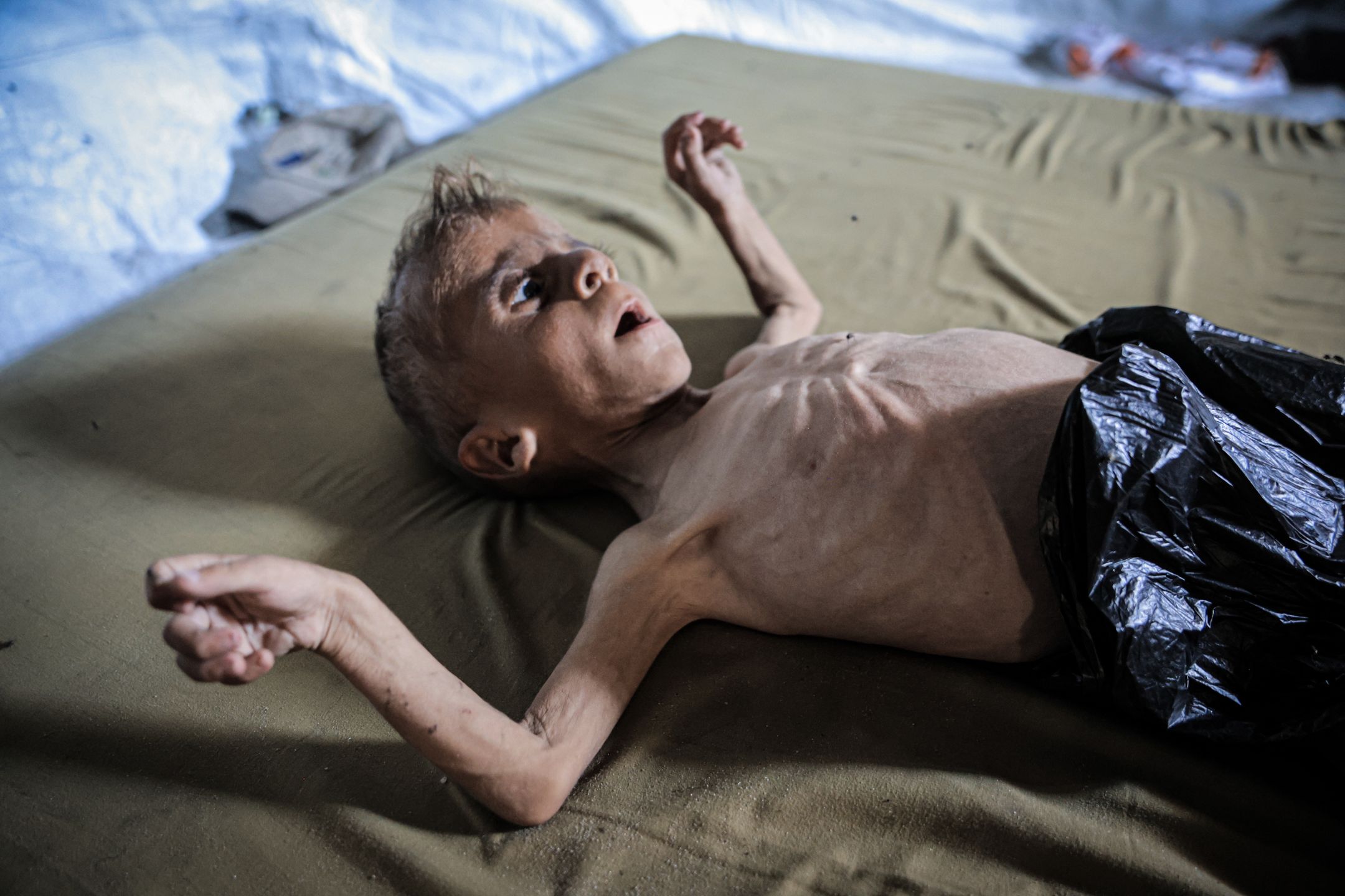 A tak chłopiec wygląda dziś. Zdjęcie z 21 lipca 2025