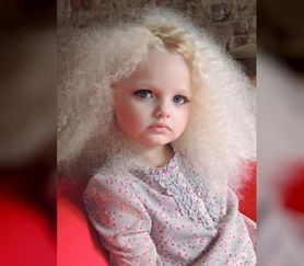 2-latkę okrzyknięto żywą lalką Barbie. Ale dawne ''atuty'' już zniknęły