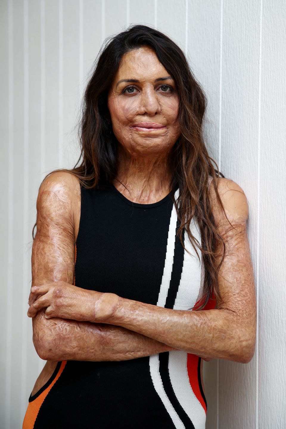 Turia Pitt