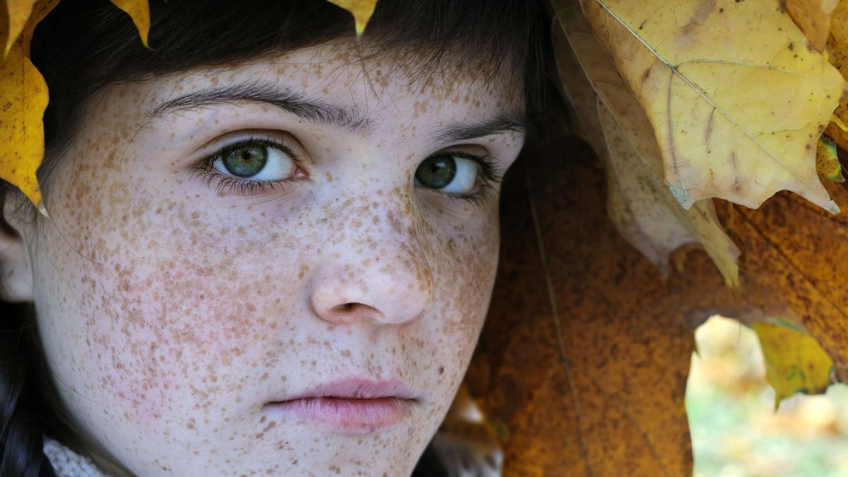 Piegi to jedna z najbardziej znanych dziedzicznych cech