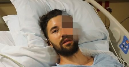 Zmiażdżona twarz i połamane biodro. Youtuber chciał zaimponować widzom