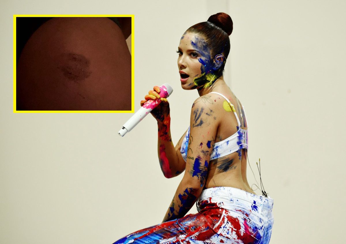 Halsey postrzelona podczas protestu Black Lives Matter