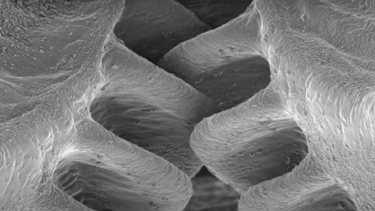 Naukowcy odkryli zębatki w organizmie owada