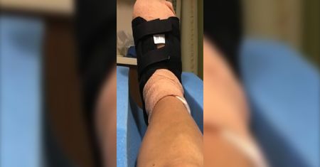 Trafiła do szpitala po wykonaniu pedicure