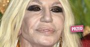 Donatella Versace "zmieniła" twarz! Po operacji odmłodniała o 20 lat! Cały świat zachwyca się tym, jak cudnie wygląda!