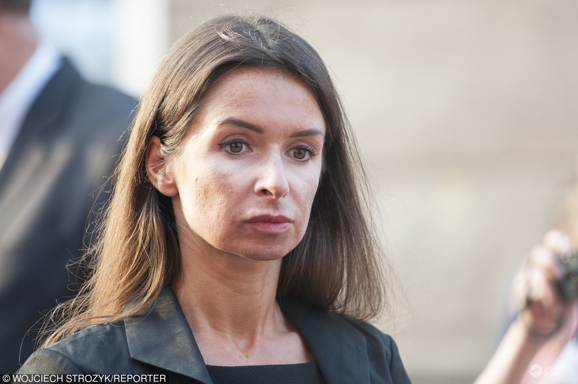 Marta Kaczyńska ma plamy na twarzy