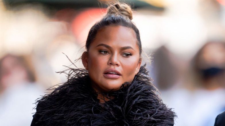 Chrissy Teigen przeszczepiła brwi. Użyła włosów z TYŁU GŁOWY (FOTO)