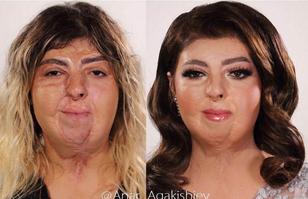Anar Agakishiev maluje kobiety ze zdeformowanymi twarzami Fot: Archiwum prywatne/Instagram @anar_agakishiev