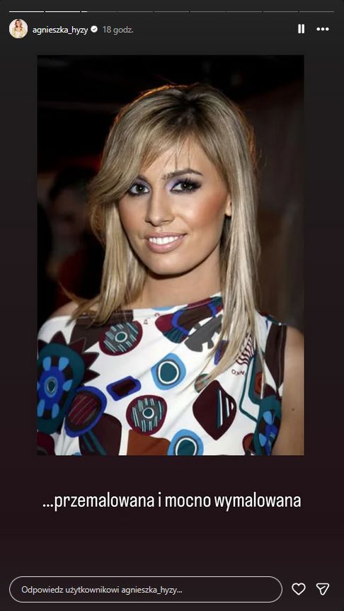 Agnieszka Hyży kiedyś