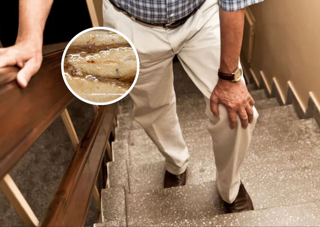 Odżywia stawy. Będą działać jak dobrze nasmarowany mechanizm