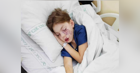 Kacper codziennie walczy z bólem. Rzadka choroba zabiera mu dzieciństwo