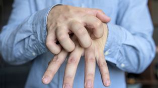 Zapomniana choroba w Kętrzynie. Potwierdzono 34 zachorowania