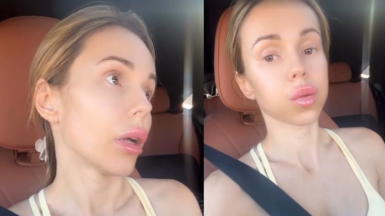 Doda narzeka na botoks