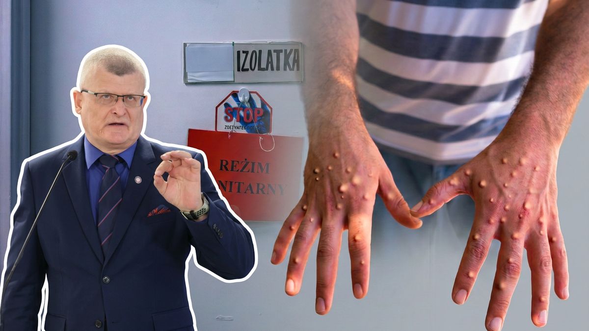 Wzrost przypadków zakażeń mpox (na zdjęciu dr Paweł Grzesiowski)