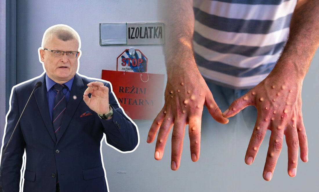 Ponad dwa razy więcej chorych na mpox. "Wirus nie wygasł"