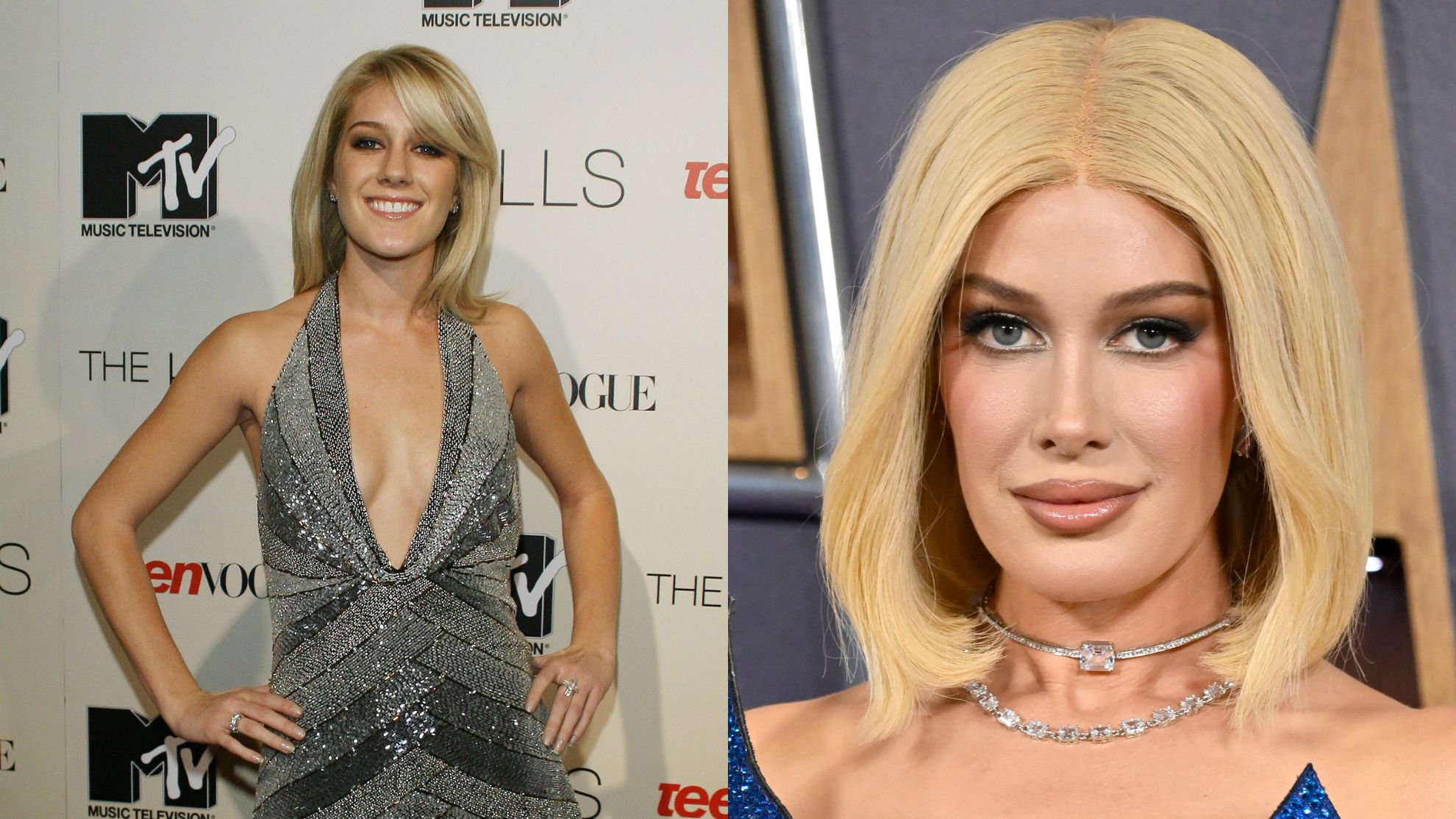 Heidi Montag przeszła 10 operacji jednego dnia