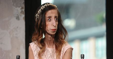 Kim jest Lizzie Velásquez? Mówią o niej "najbrzydsza kobieta świata"