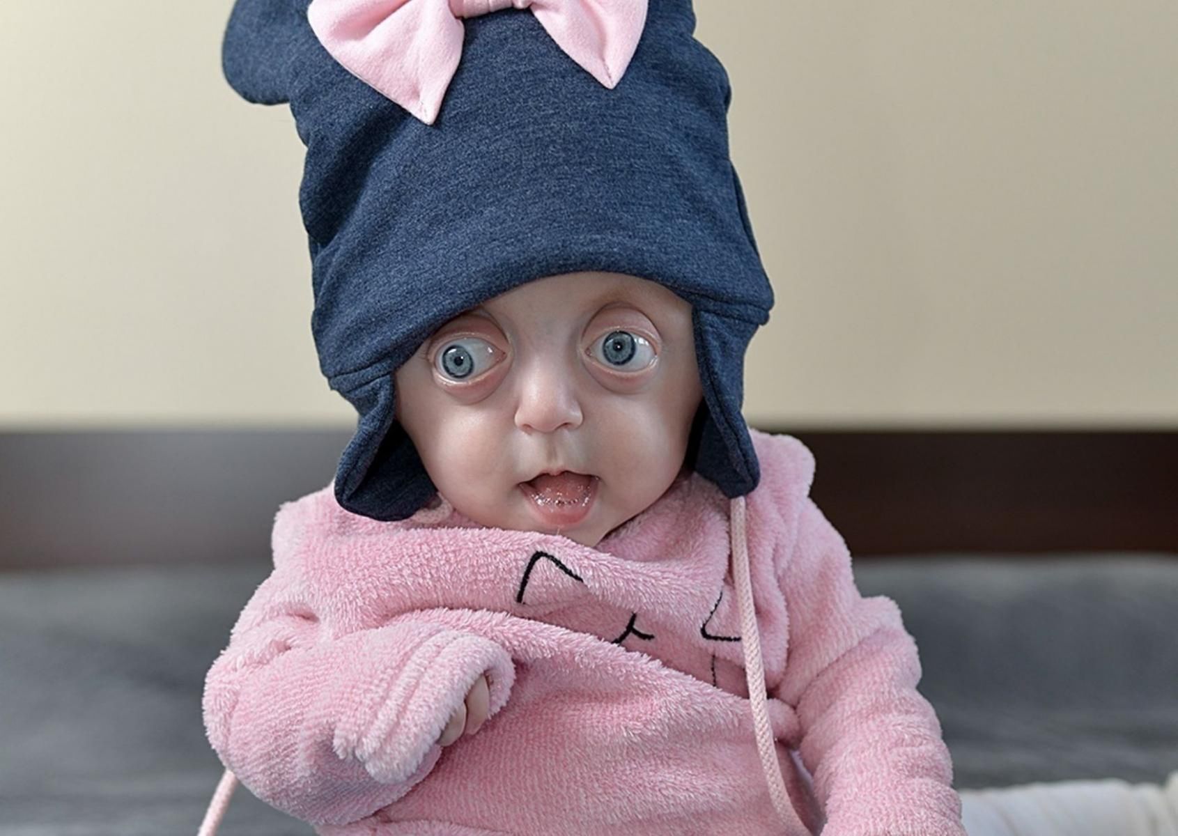 6-miesięczna Hania czeka na operację, która uratuje jej życie