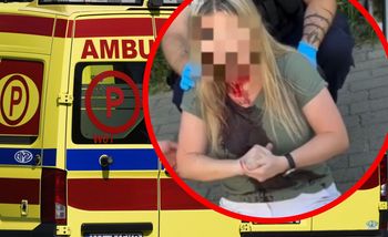 Brutalny atak na kobietę z Ukrainy w Gdyni. Trwają poszukiwania sprawcy