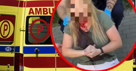 Brutalny atak na kobietę z Ukrainy w Gdyni. Trwają poszukiwania sprawcy