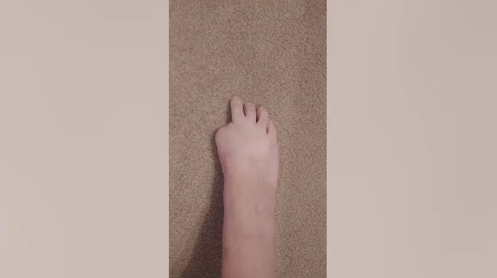 Nie przypuszczała, że skończy się amputacją