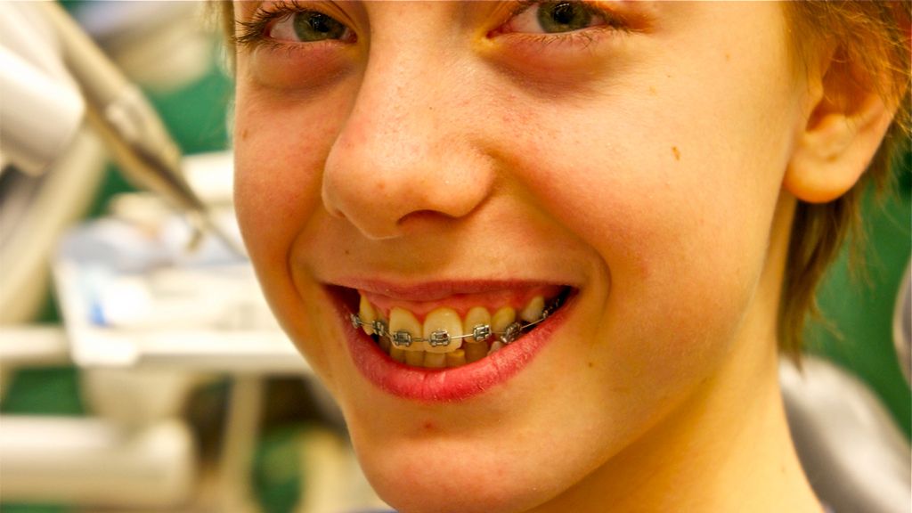 Korekta kształtu zębów