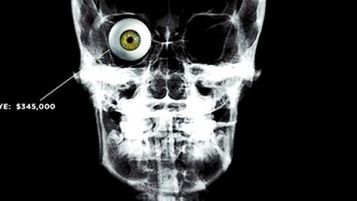 Ile zapłaciłbyś za nowe organy? 1