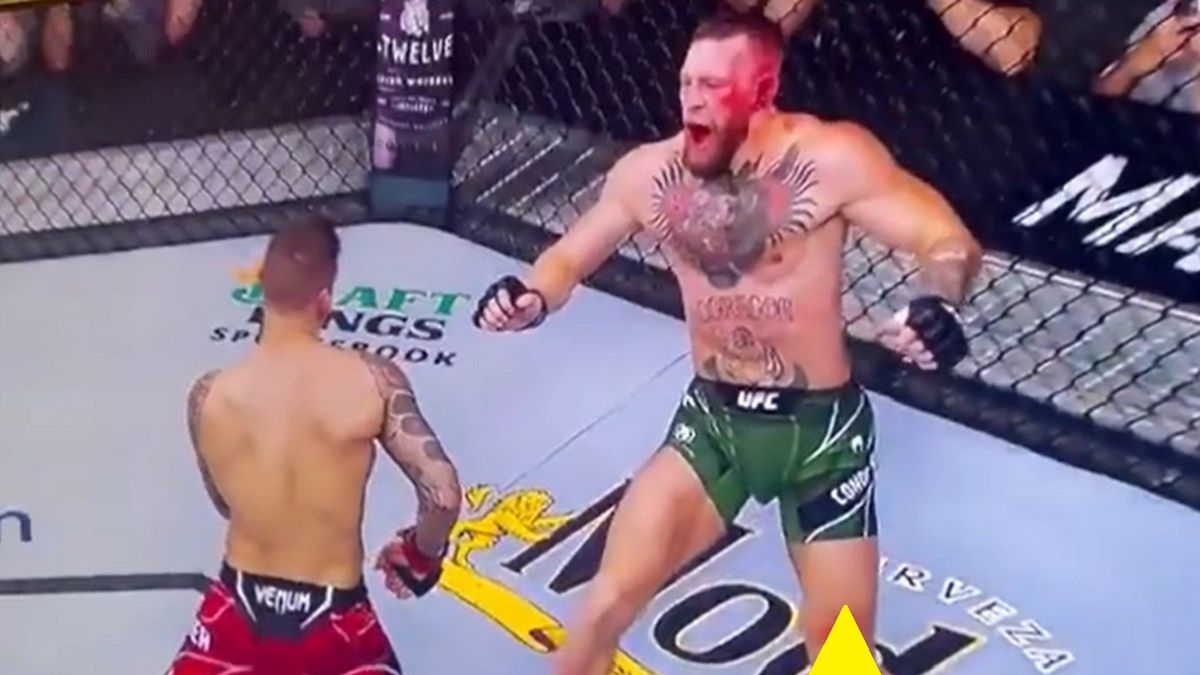 Kontuzja Conora McGregora