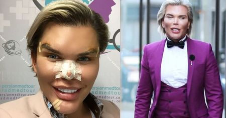 "Żywy Ken" wkrótce może zostać… "żywą Barbie": "Mój penis jest jedyną prawdziwą częścią mnie"