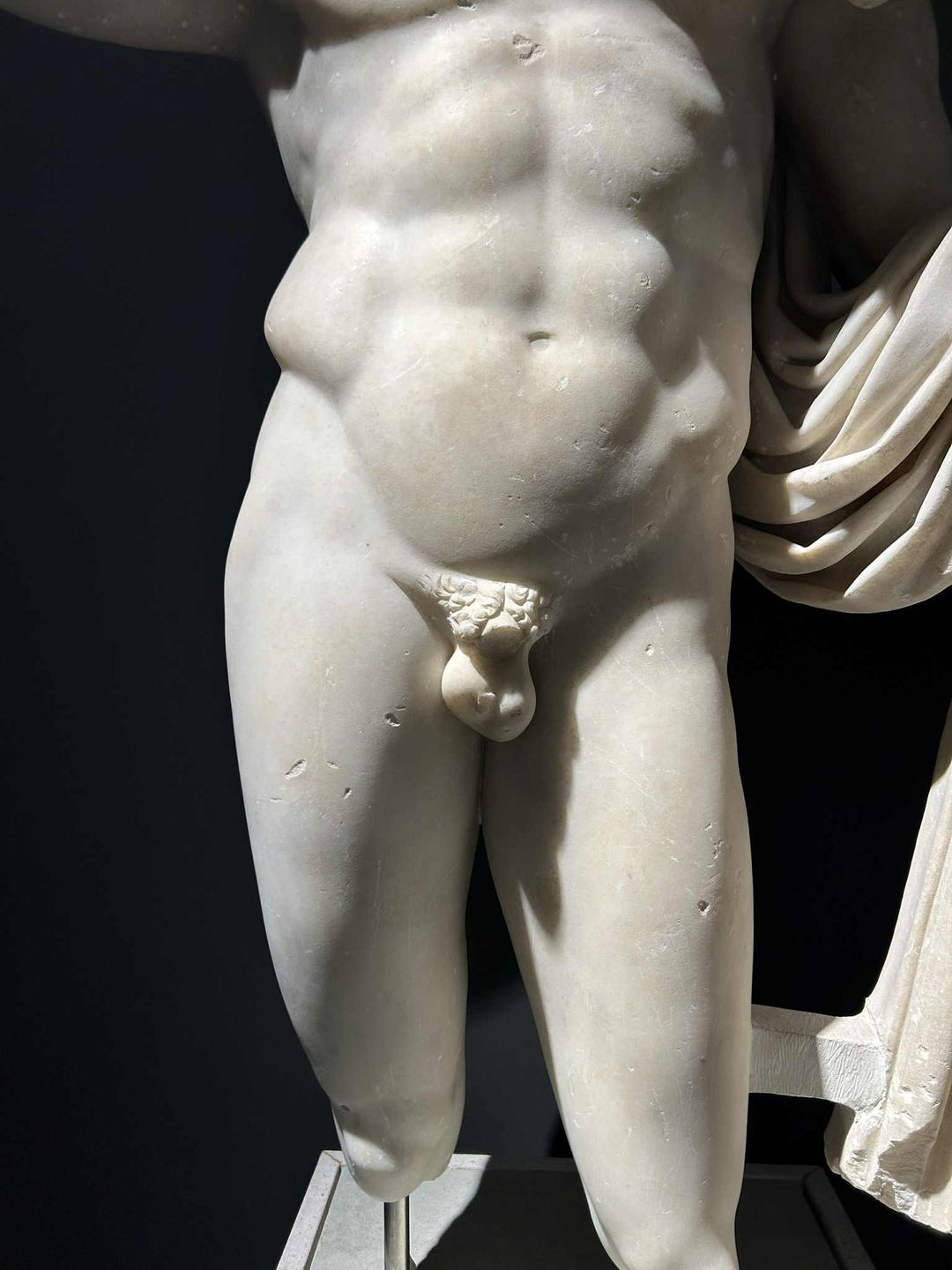 Brak genitaliów to nie zawsze efekt upływu czasu