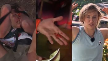 Katarzyna Zillmann ROZCIĘŁA GŁOWĘ w "Azji Express": "Oh, sh*t, KREW"