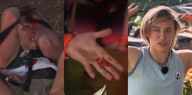Katarzyna Zillmann ROZCIĘŁA GŁOWĘ w "Azji Express": "Oh, sh*t, KREW"