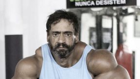 Jest uzależniony od syntholu. Brazylijskiemu mięśniakowi grozi amputacja